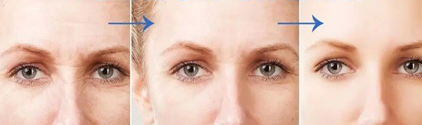 Anti-aging younger healthier Anti-aging younger healthier